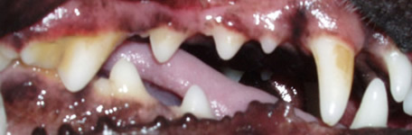 stage 1 dental disease