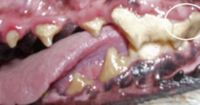 stage 4 dental disease