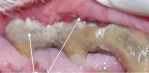 stage 4 dental disease