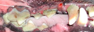 stage 4 dental disease